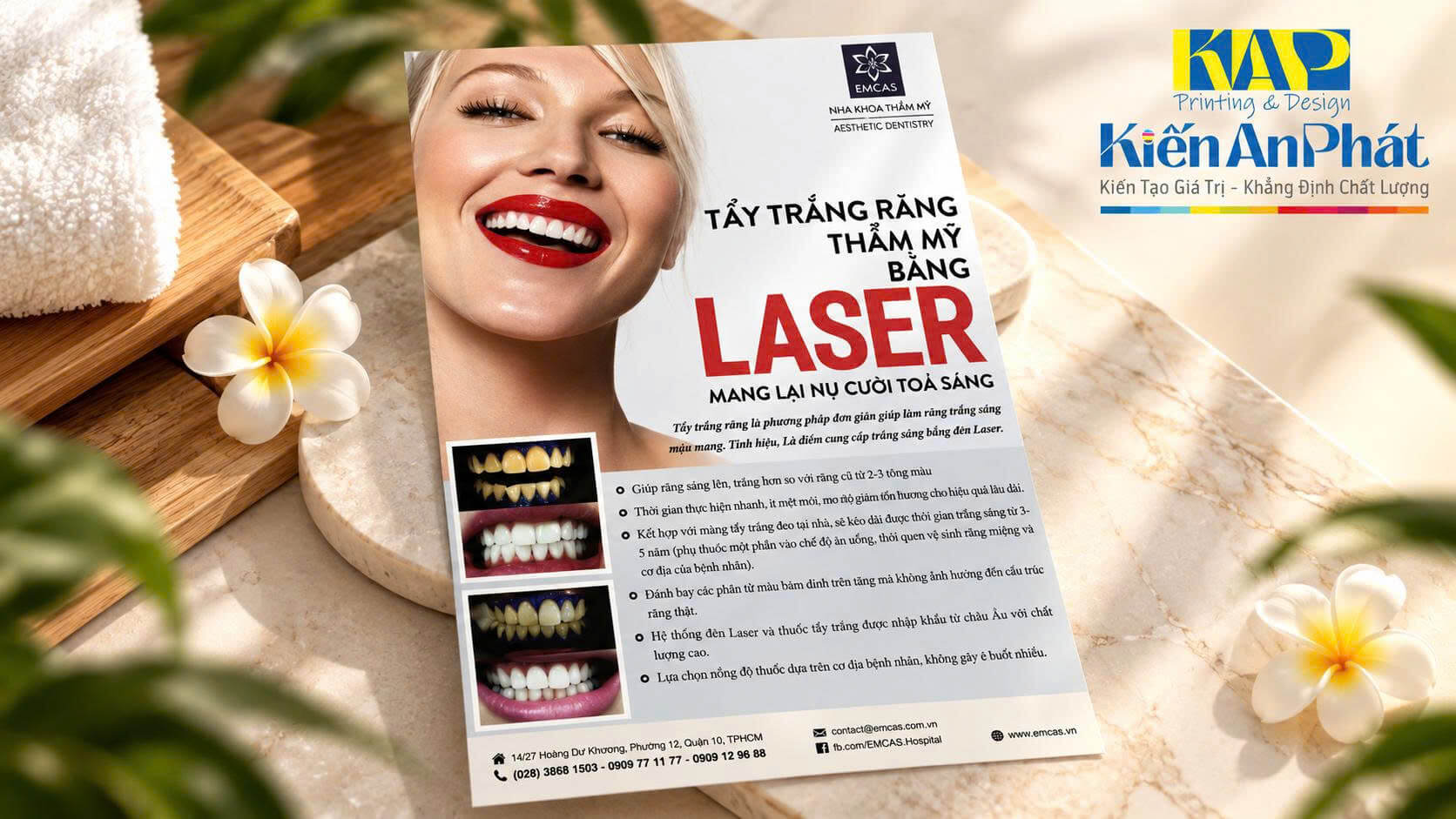 In Tờ Rơi Nha Khoa Đẹp, Uy Tín Giá Xưởng Tại Bình Thạnh, TPHCM
